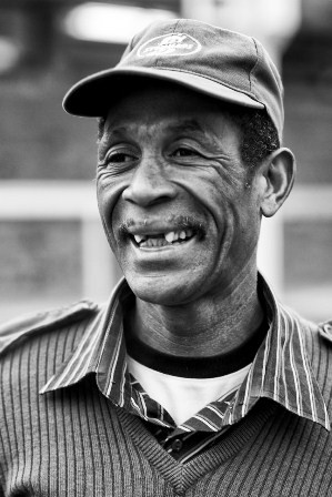 Nhổ răng cửa để làm đẹp đã xuất hiện tại Nam Phi ít nhất 60 năm. Nhổ răng cửa để làm đẹp đã xuất hiện tại Nam Phi ít nhất 60 năm