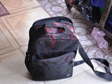 Chiếc túi của đại lý vé số bị biến dạng vì axit