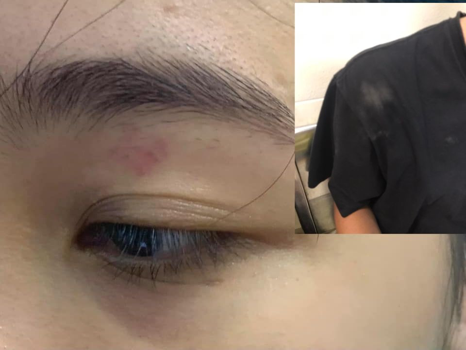 Nạn nhân bị hai nhân viên cửa hàng bánh mỳ Nguyên Sinh hành hung.