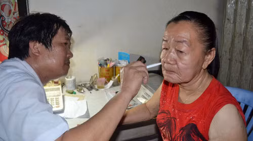 Bác sĩ Hoàng Văn Minh, trưởng phòng khám da liễu Bệnh viện Đại học Y dược, khám da mặt chị Phượng. Ảnh: VIỄN SỰ