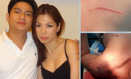 Dời ngày xử nhóm người chém bác sĩ Chiêm Quốc Thái ảnh 1