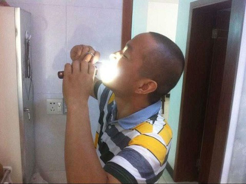 Người đàn ông tự 'phẫu thuật' cắt khối u trong miệng hơn 10 lần ảnh 1