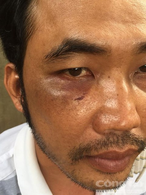 Phóng hỏa thiêu sống thương lái sầu riêng để giành lãnh địa ảnh 2