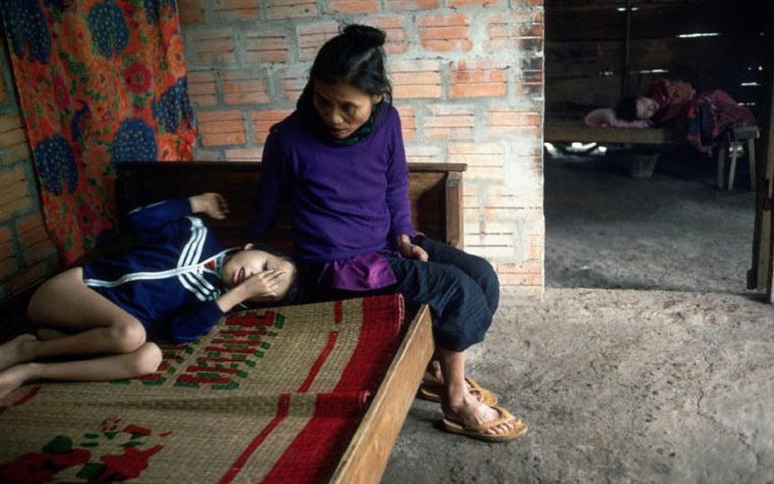 Một bức ảnh về nạn nhân chất độc da cam tại Triển lãm "Da cam - Lương tri và Công lý".