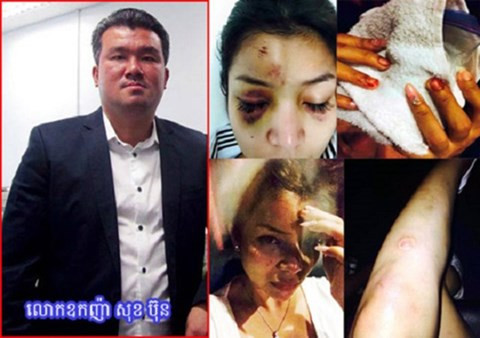 Đại gia bất động sản hành hung dã man ngôi sao truyền hình ảnh 3