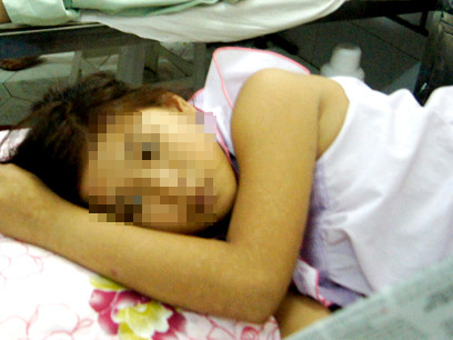 Bé gái 12 tuổi đang được điều trị