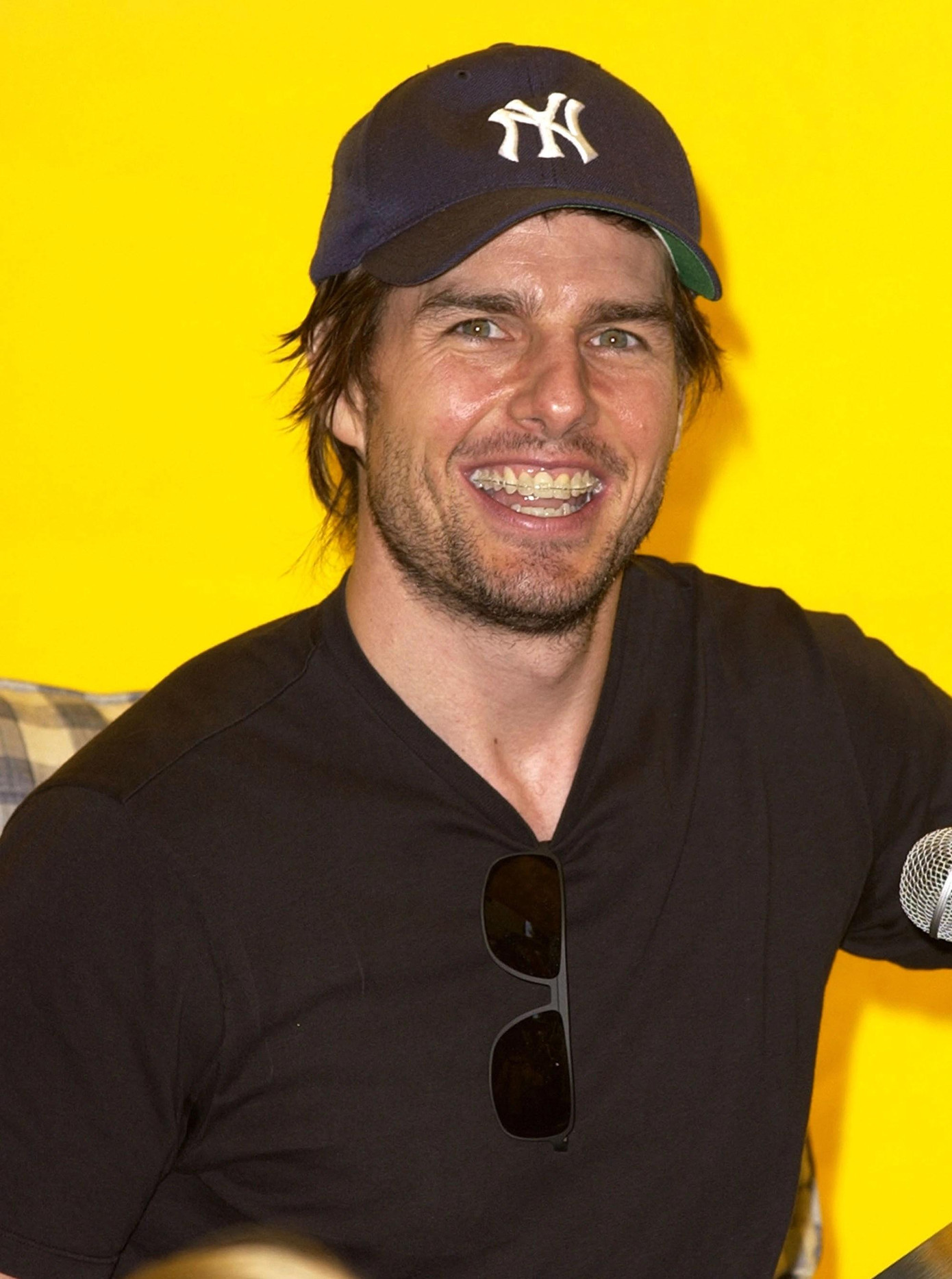 Năm 2002, nam diễn viên đình đám gây chú ý vì niềng răng để sửa lại nụ cười triệu USD của mình.