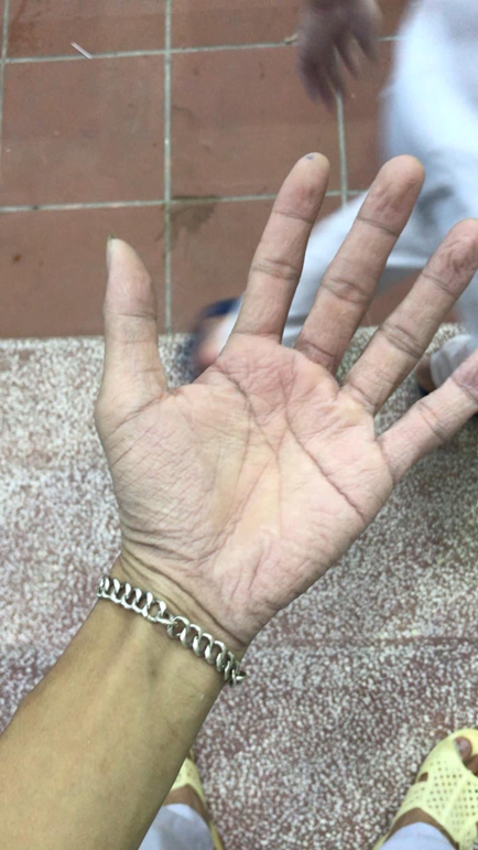 Ảnh dự thi “Đôi bàn tay không thở” của sinh viên Y.K52E Trần Văn Hảo đạt giải Nhất cuộc thi “Sắc xanh tình nguyện” do Hội sinh viên Đại học Thái Nguyên tổ chức.