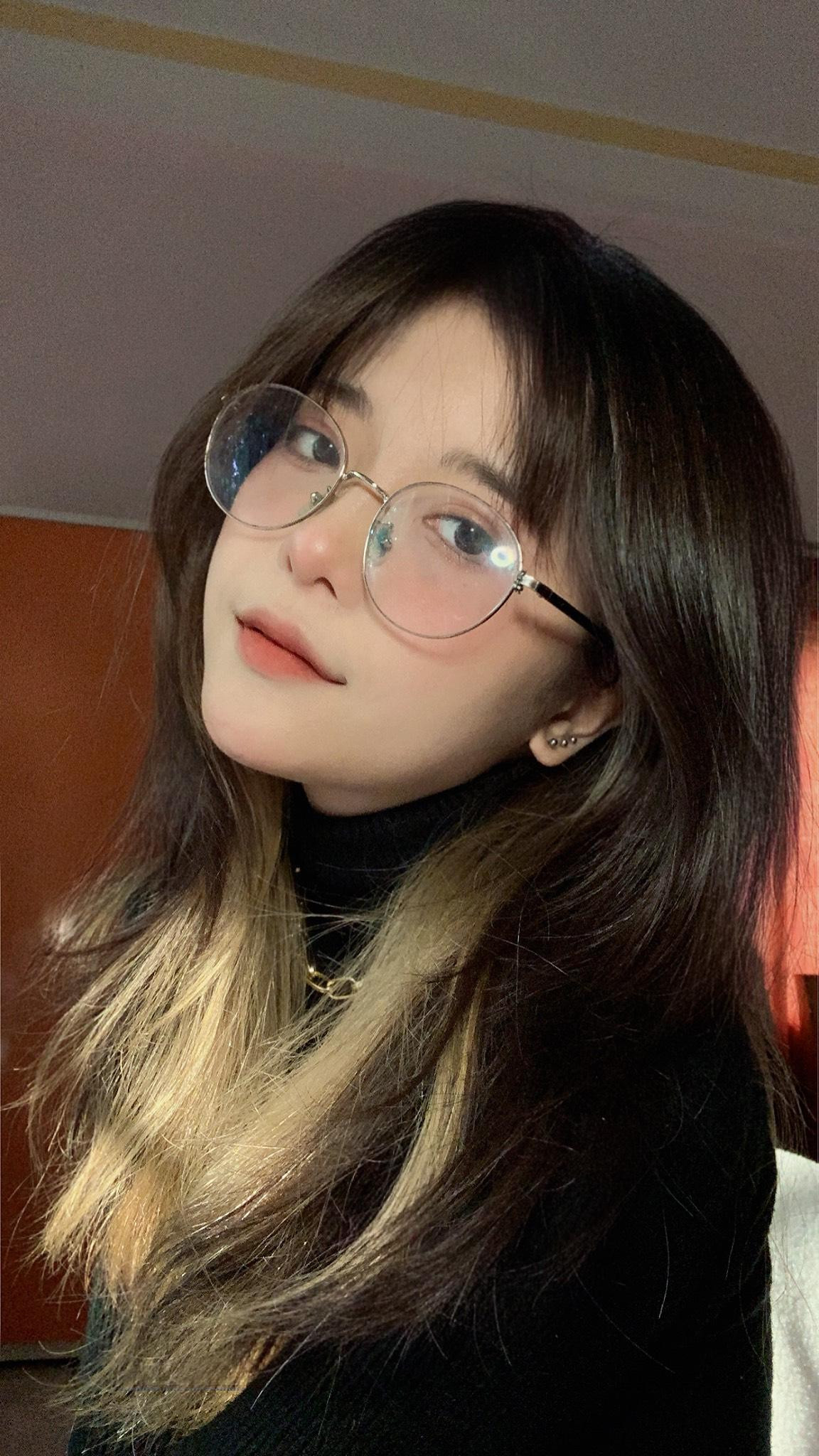 Do bạch biến đã khiến từ nhỏ cô có một vùng tóc trắng muốt