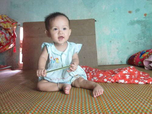 Bình thường bé Ánh rất vui vẻ, nhưng mỗi khi đi ngoài cháu lại khóc vì đau. Ảnh: Hải Bình.