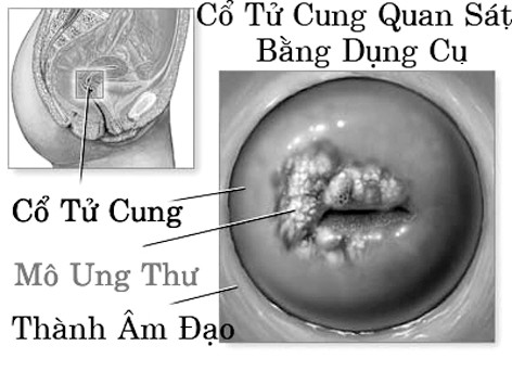 Ảnh minh họa. Ảnh minh họa