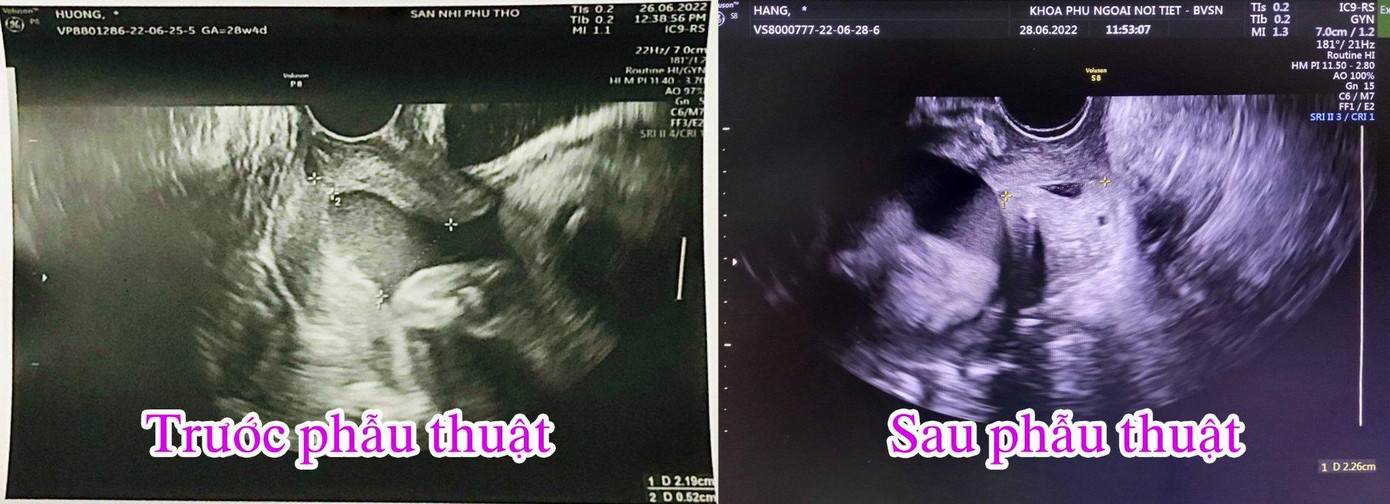 Ảnh: BS cung cấp