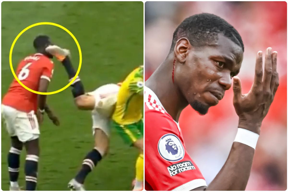 Một trong nhiều pha lỗi hài hước của Maguire