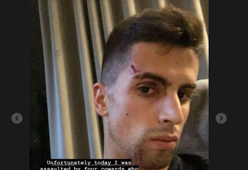 Cancelo đăng bức hình về vết tích sau vụ xô xát