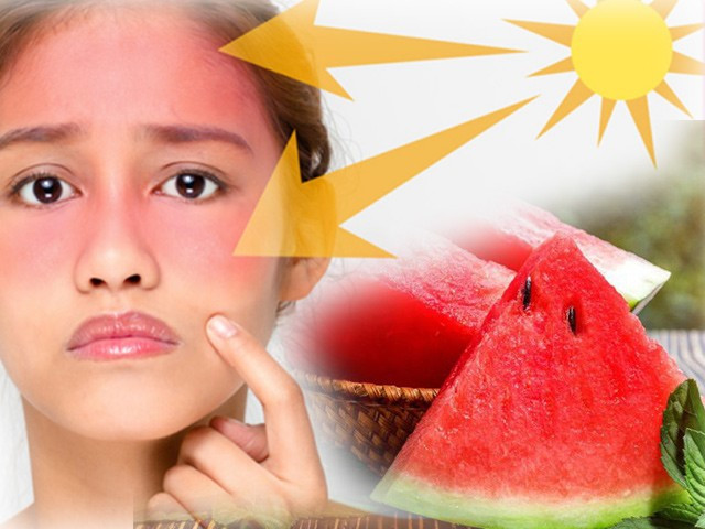 Bổ sung dưa hấu trong mùa Hè sẽ rất có lợi cho da. Bổ sung dưa hấu trong mùa Hè sẽ rất có lợi cho da.