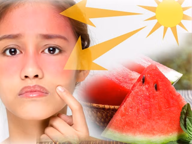 Bổ sung dưa hấu trong mùa Hè sẽ rất có lợi cho da.