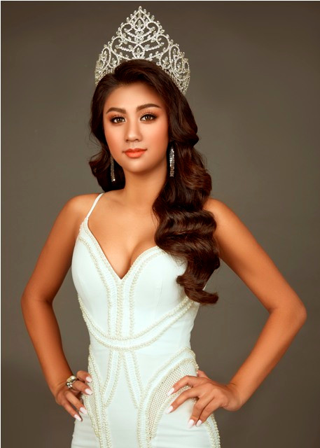 Hoa hậu Vy Nguyễn về Việt Nam thăm và tặng quà cho trẻ em mồ côi khuyết tật ảnh 2