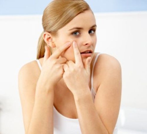 Việc nặn mụn sẽ làm cho tình trạng mụn càng tệ hơn. Việc nặn mụn sẽ làm cho tình trạng mụn càng tệ hơn