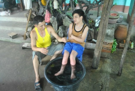 Do bệnh tật hành hạ, hai ống chân của Bắc nóng rát khó chịu, nên em thường xuyên phải ngâm chân vào nước lạnh để giải nhiệt