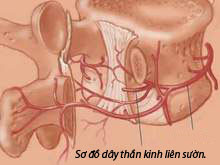 Ðau dây thần kinh liên sườn - Chớ coi thường