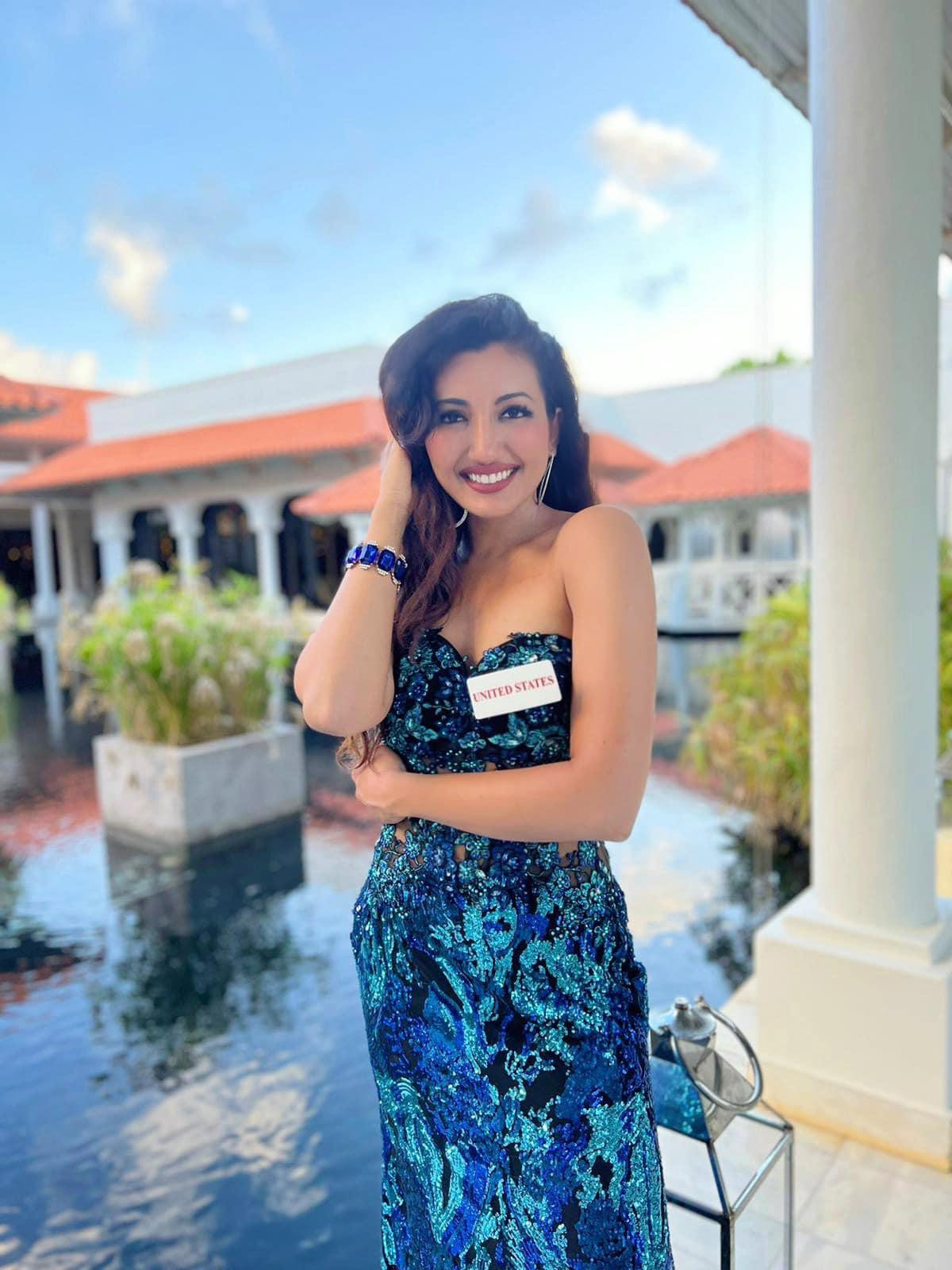 Hiện tại, Shree Saini vẫn dùng quạt làm mát để giảm những cơn đau rát do vết bỏng khi ngủ. Hiện tại, Shree Saini vẫn dùng quạt làm mát để giảm những cơn đau rát do vết bỏng khi ngủ.