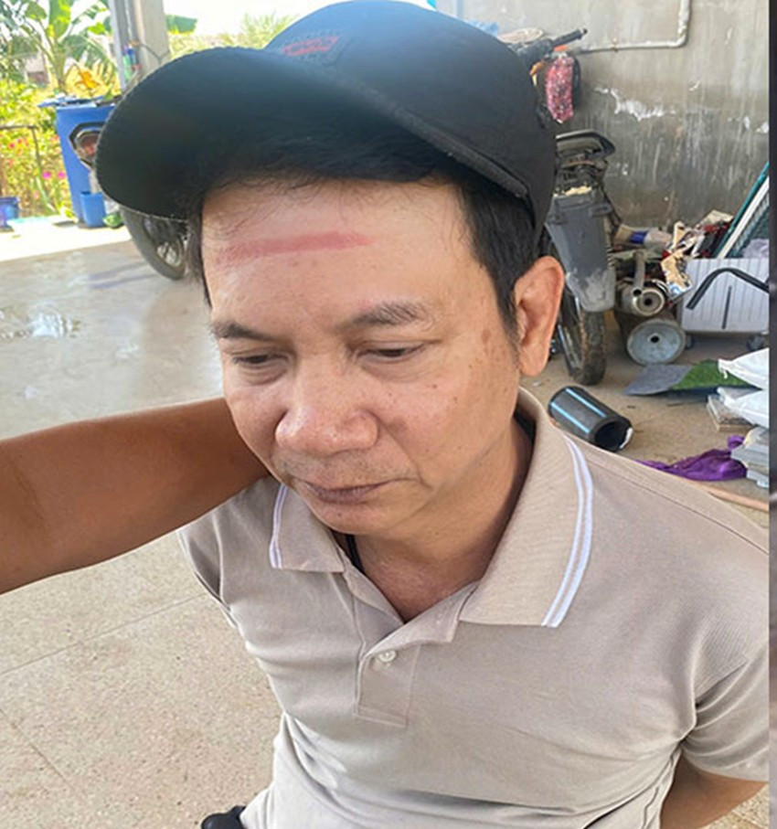 Đối tượng Trần Quốc Hưng lúc bị bắt. Đối tượng Trần Quốc Hưng lúc bị bắt.