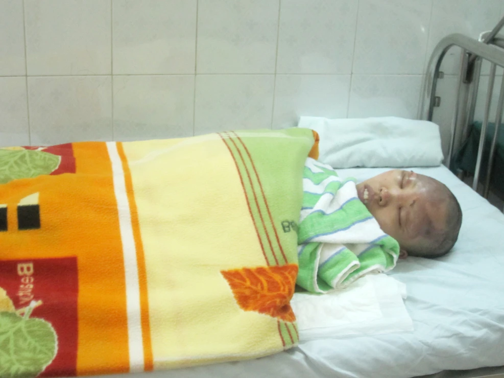 Bệnh nhân Đào Thị Nga (28 tuổi) bỏng lửa 17%, bỏng sâu 7%. Ảnh: Tuấn Nguyễn