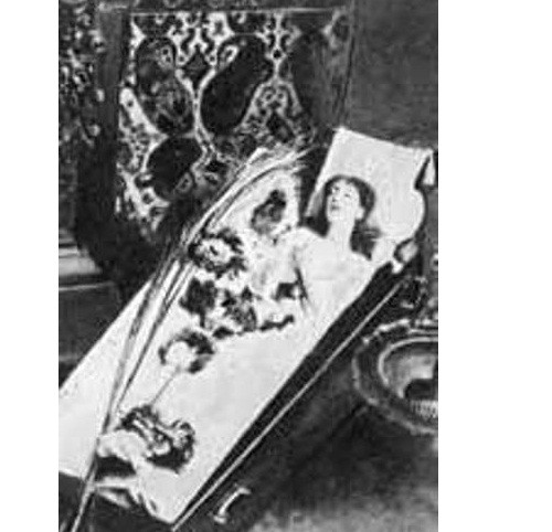 Hiện tượng bí ẩn xoay quanh bé gái mắc chứng hôn thụy ngủ suốt 16 năm ròng