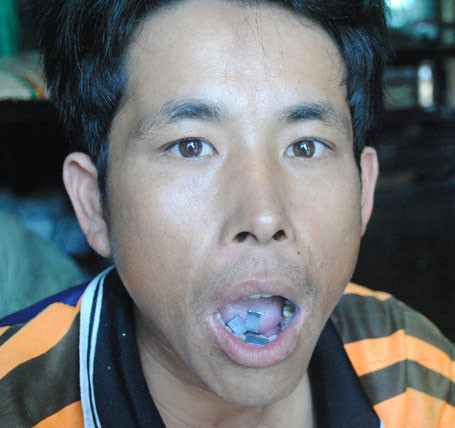 Người dân Mỹ Thạnh mưu sinh bằng nghề độc 