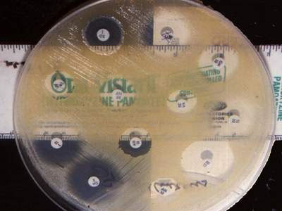  Làm kháng sinh đồ để lựa chọn kháng sinh thích hợp