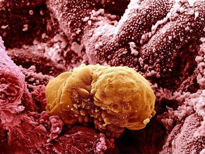 Hình ảnh phôi thai 6 ngày tuổi đang làm tổ trong dạ con. Hình ảnh phôi thai 6 ngày tuổi đang làm tổ trong dạ con