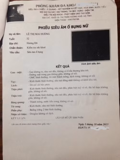 Tá hỏa mất nửa lá lách sau khi mổ chửa ngoài tử cung ảnh 1