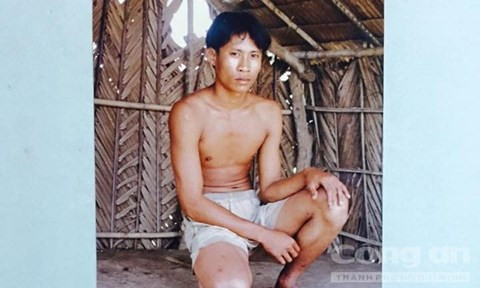 Bắt gọn kẻ sát nhân từ vết cắn bí ẩn trên ngực trái cô gái ảnh 1