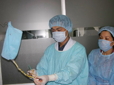  Lấy cuống rốn xử lý và lưu trữ chuẩn bị cho ca ghép