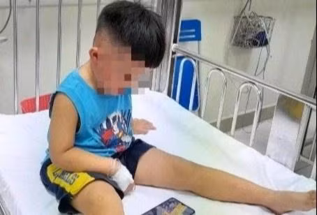 Bé trai 3 tuổi tại bệnh viện. Ảnh: Bệnh viện cung cấp. chau be bi nhot trong tu cap dong anh 2