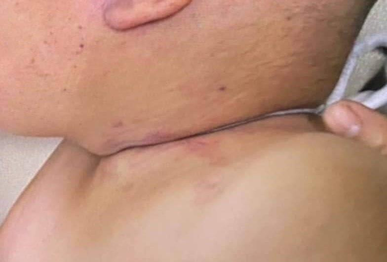 chau be bi nhot trong tu cap dong anh 3