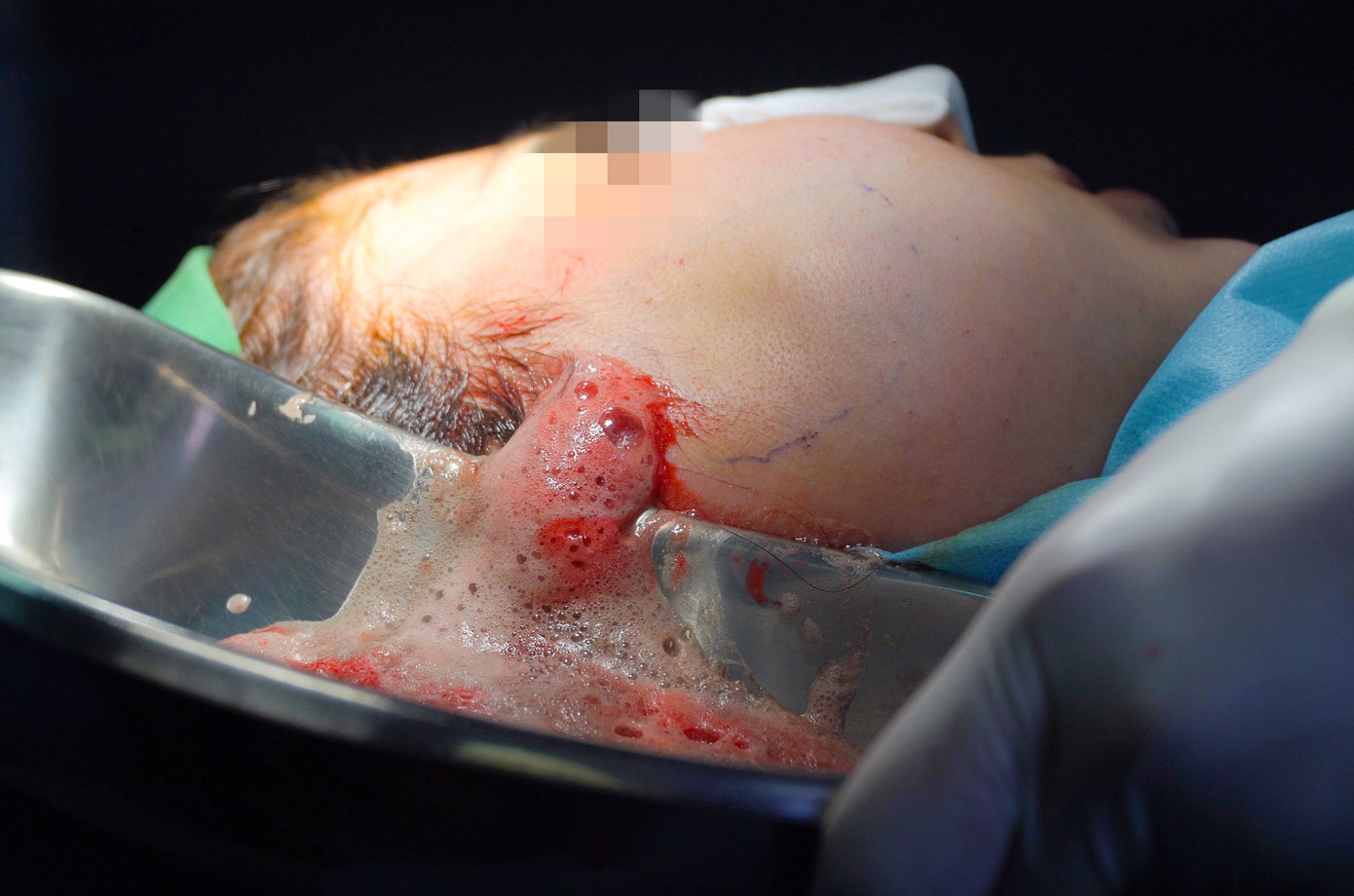 Thời gian qua, nhiều vụ tai biến thẩm mỹ đã xảy ra do các cơ sở thẩm mỹ chui gây nên Thời gian qua, nhiều vụ tai biến thẩm mỹ đã xảy ra do các cơ sở thẩm mỹ chui gây nên