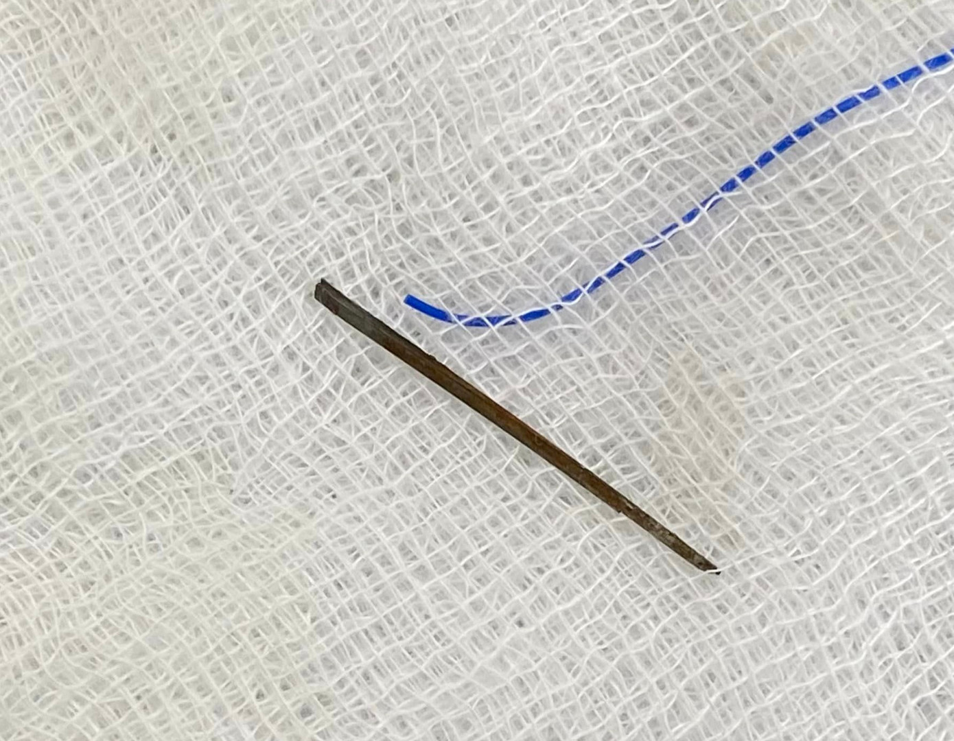 Mảnh sắt nhỏ sắc nhọn xuyên vào cơ thể suýt cướp đi sinh mạng nam công nhân Mảnh sắt nhỏ sắc nhọn xuyên vào cơ thể suýt cướp đi sinh mạng nam công nhân