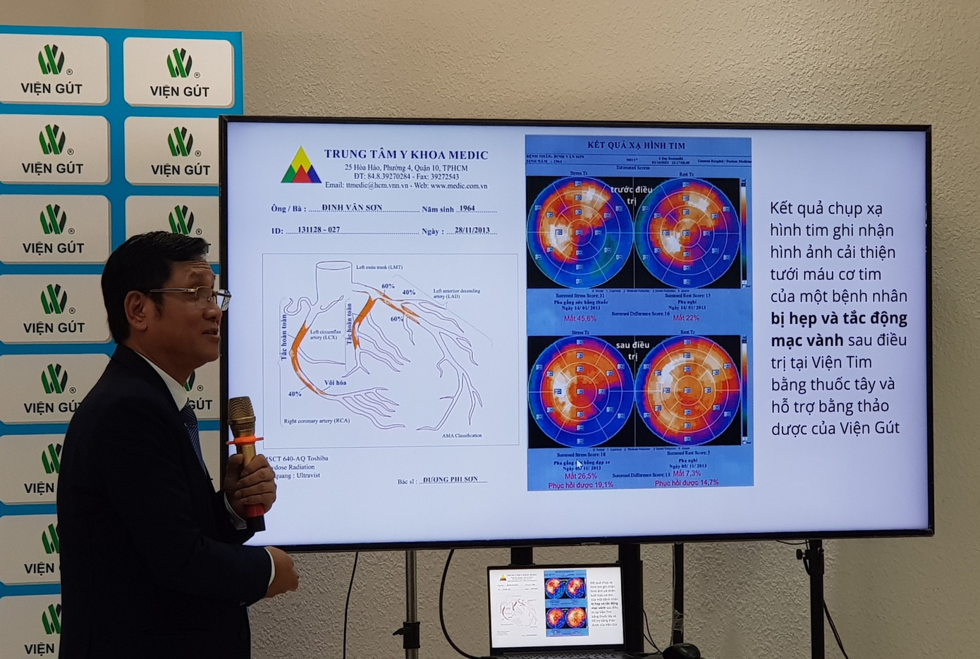 Các chuyên gia nhận định, bệnh gút đang là thách thức lớn nhưng có thể chữa khỏi Các chuyên gia nhận định, bệnh gút đang là thách thức lớn nhưng có thể chữa khỏi