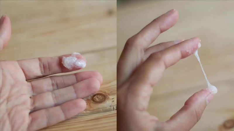 Khi hư bệnh lý ở những nữ bệnh nhân mắc bệnh lậu (ảnh minh họa) Khi hư bệnh lý ở những nữ bệnh nhân mắc bệnh lậu (ảnh minh họa)