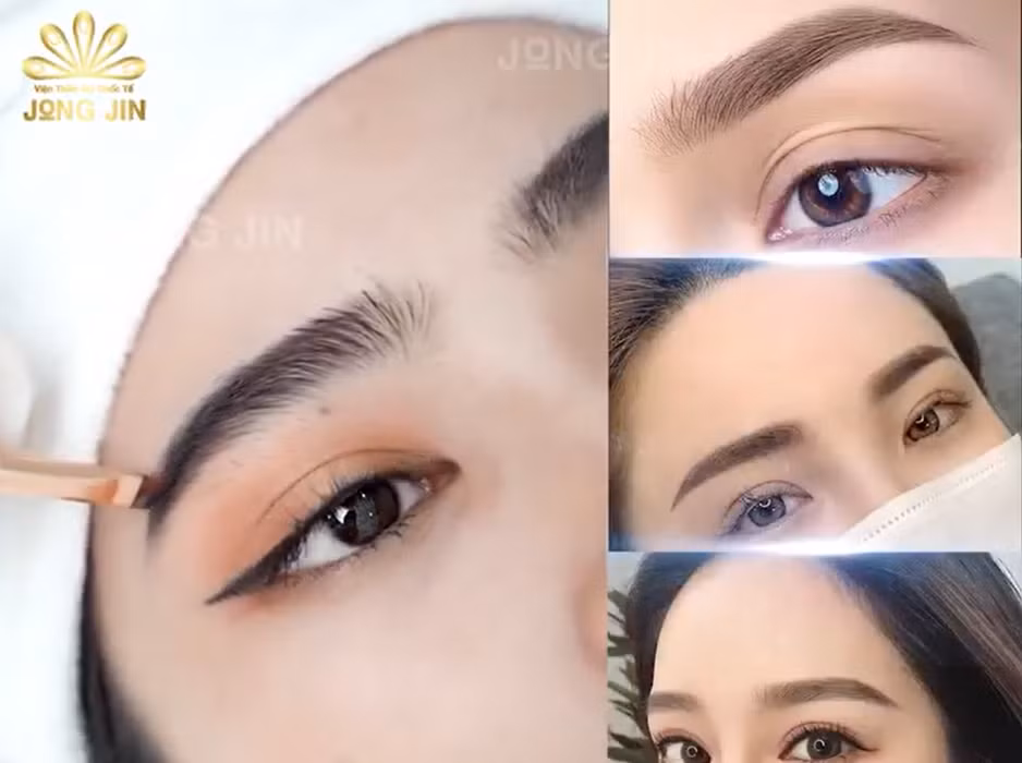 Hình ảnh quảng cáo trên mạng xã hội của cơ sở Viện Thẩm mỹ Quốc tế JONGJIN