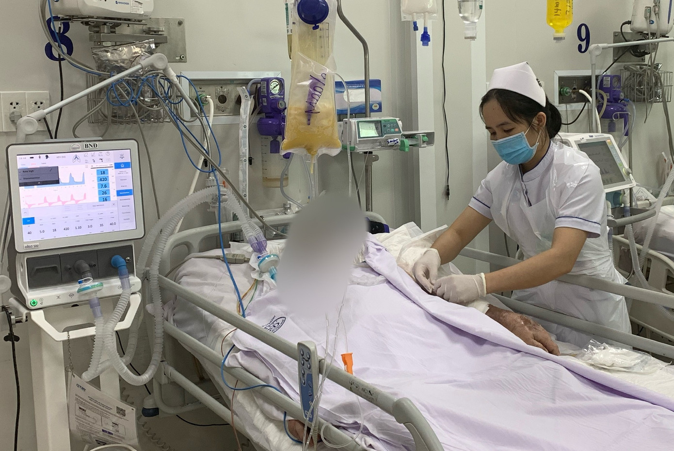 Hai anh em bệnh nhân thời điểm điều trị tại Bệnh viện Chợ Rẫy do ngộ độc Botulinum Hai anh em bệnh nhân thời điểm điều trị tại Bệnh viện Chợ Rẫy do ngộ độc Botulinum