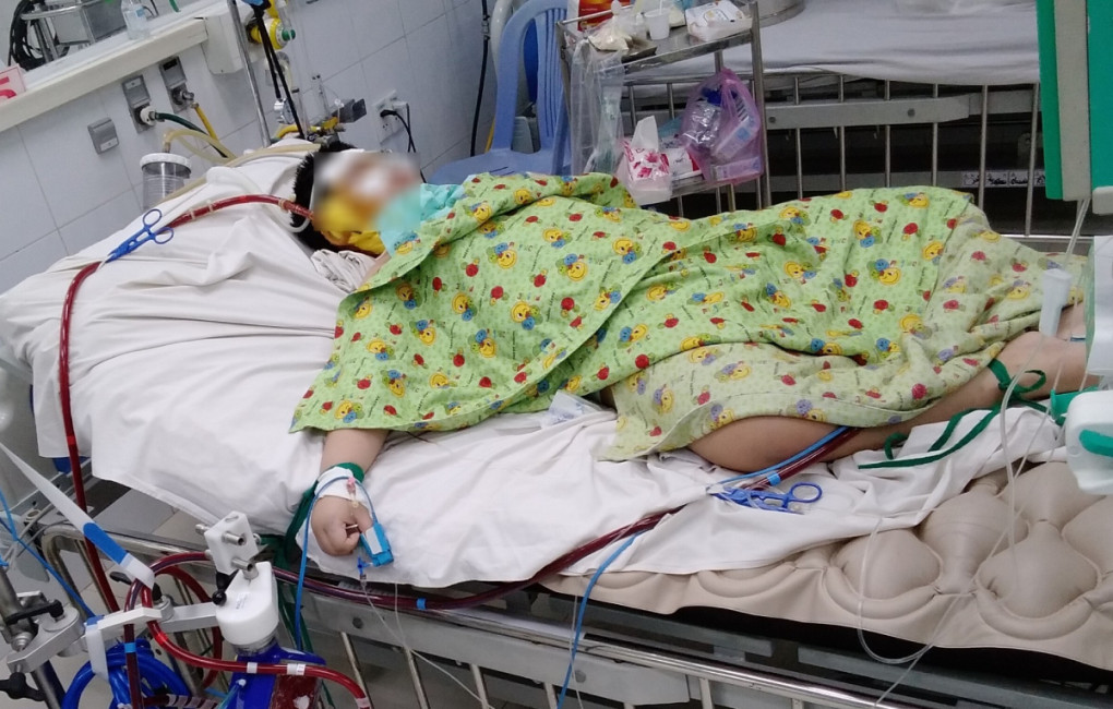 Bệnh nhi nguy kịch tính mạng phải chạy ECMO tại Bệnh viện Nhi Đồng 2 Bệnh nhi nguy kịch tính mạng phải chạy ECMO tại Bệnh viện Nhi Đồng 2
