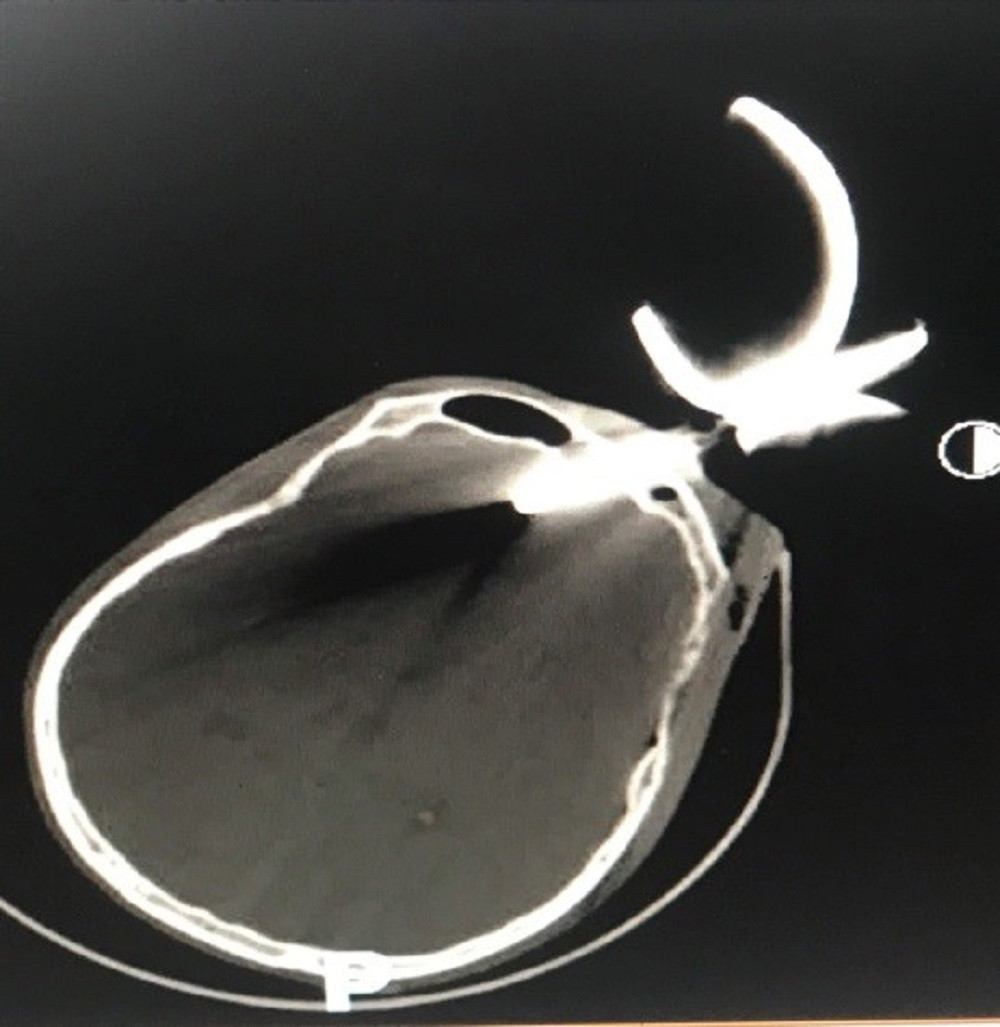 Kết quả kiểm tra hình ảnh của bệnh nhân Kết quả kiểm tra hình ảnh của bệnh nhân