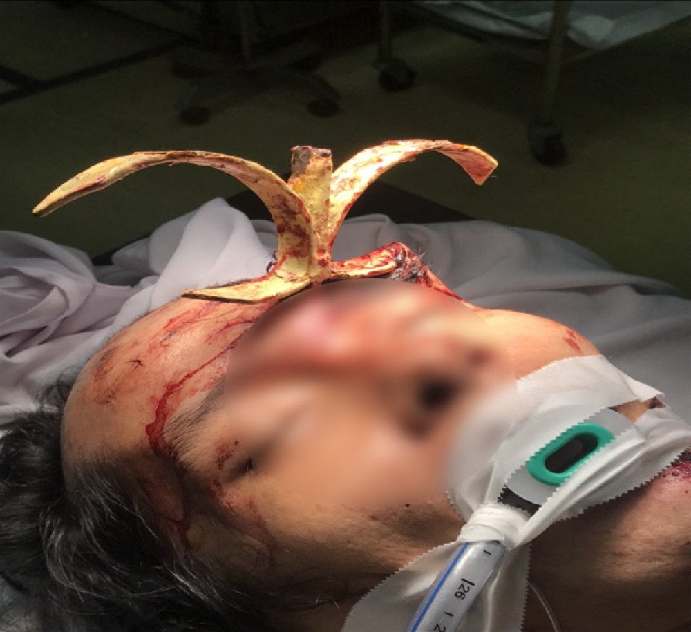 Nạn nhân sau khi được đưa vào bệnh viện cấp cứu Nạn nhân sau khi được đưa vào bệnh viện cấp cứu