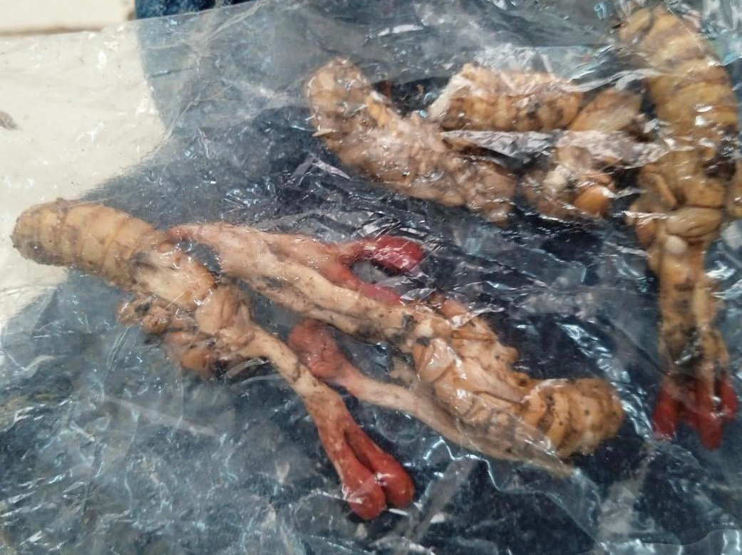 Những cây nấm độc ký sinh trên nhộng ve sầu bệnh nhân chưa sử dụng hết được thân nhân mang đến bệnh viện Những cây nấm độc ký sinh trên nhộng ve sầu bệnh nhân chưa sử dụng hết được thân nhân mang đến bệnh viện