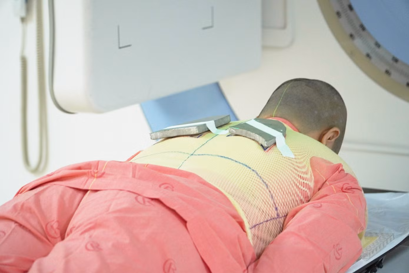 Sau khi xạ trị toàn thân và ghép tế bào gốc đồng loại, bệnh nhân đã trở lại cuộc sống bình thường Sau khi xạ trị toàn thân và ghép tế bào gốc đồng loại, bệnh nhân đã trở lại cuộc sống bình thường