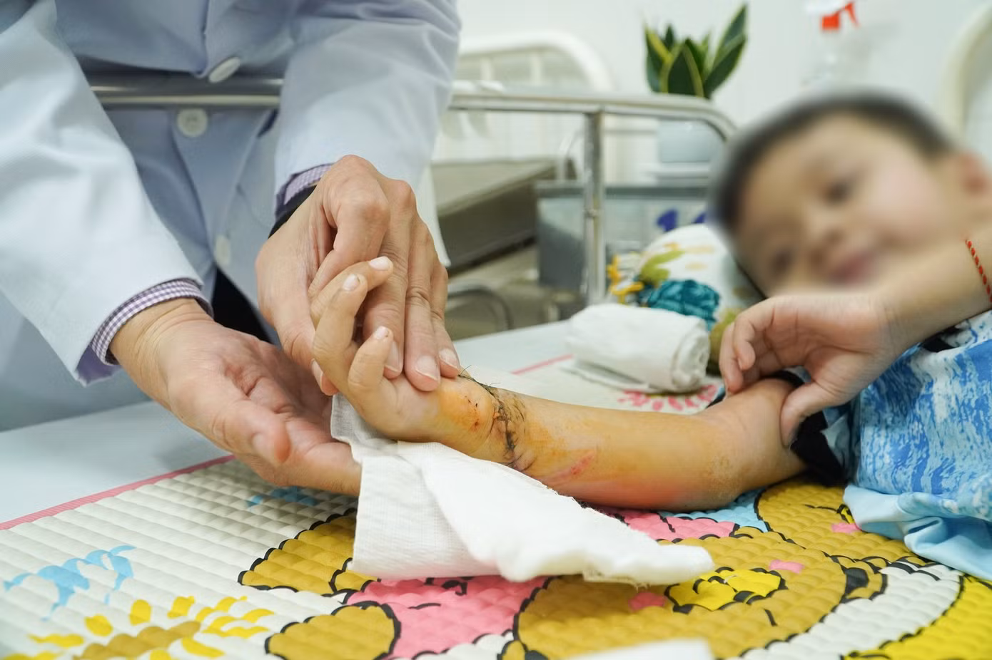 Các bác sĩ đã thực hiện thành công cuộc phẫu thuật nối lại bàn tay cho bệnh nhi Các bác sĩ đã thực hiện thành công cuộc phẫu thuật nối lại bàn tay cho bệnh nhi