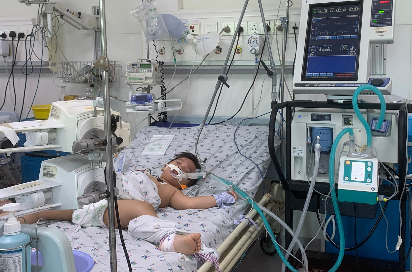 Một trường hợp mắc tay chân miệng diễn tiến nặng điều trị tại Bệnh viện Nhi Đồng Thành Phố Một trường hợp mắc tay chân miệng diễn tiến nặng điều trị tại Bệnh viện Nhi Đồng Thành Phố