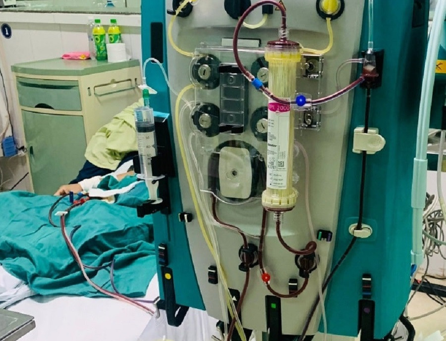 Nạn nhân ngộ độc Botulinum rất khó cứu chữa nếu không có thuốc giải độc (ảnh: BVCC) Nạn nhân ngộ độc Botulinum rất khó cứu chữa nếu không có thuốc giải độc (ảnh: BVCC)